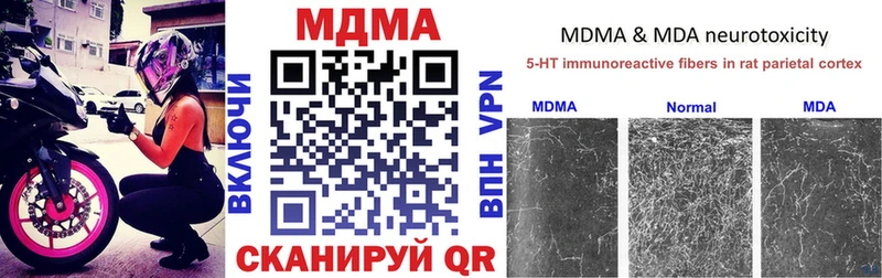 MDMA VHQ  Шумиха 